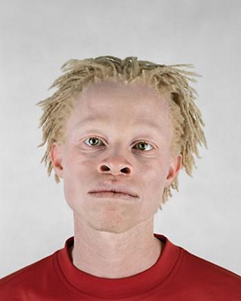 Albino Funny